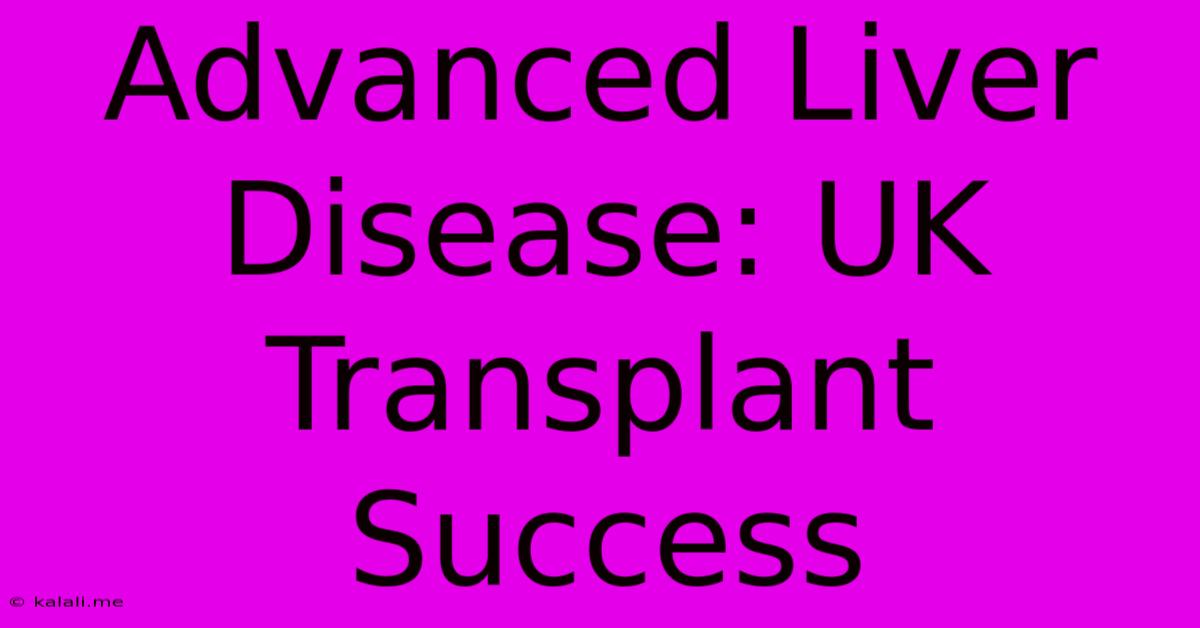 Advanced Liver Disease: UK Transplant Success