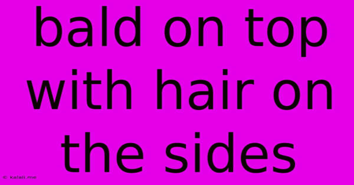 Bald On Top With Hair On The Sides