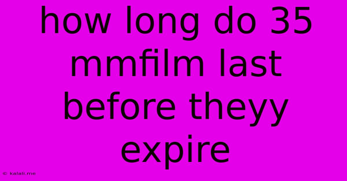 How Long Do 35 Mmfilm Last Before Theyy Expire