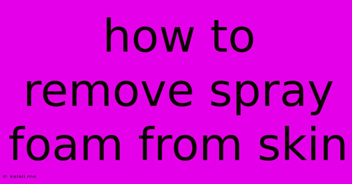 How To Remove Spray Foam From Skin