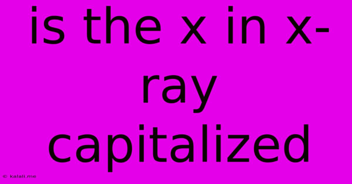 Is The X In X-ray Capitalized