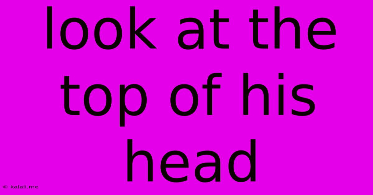 Look At The Top Of His Head
