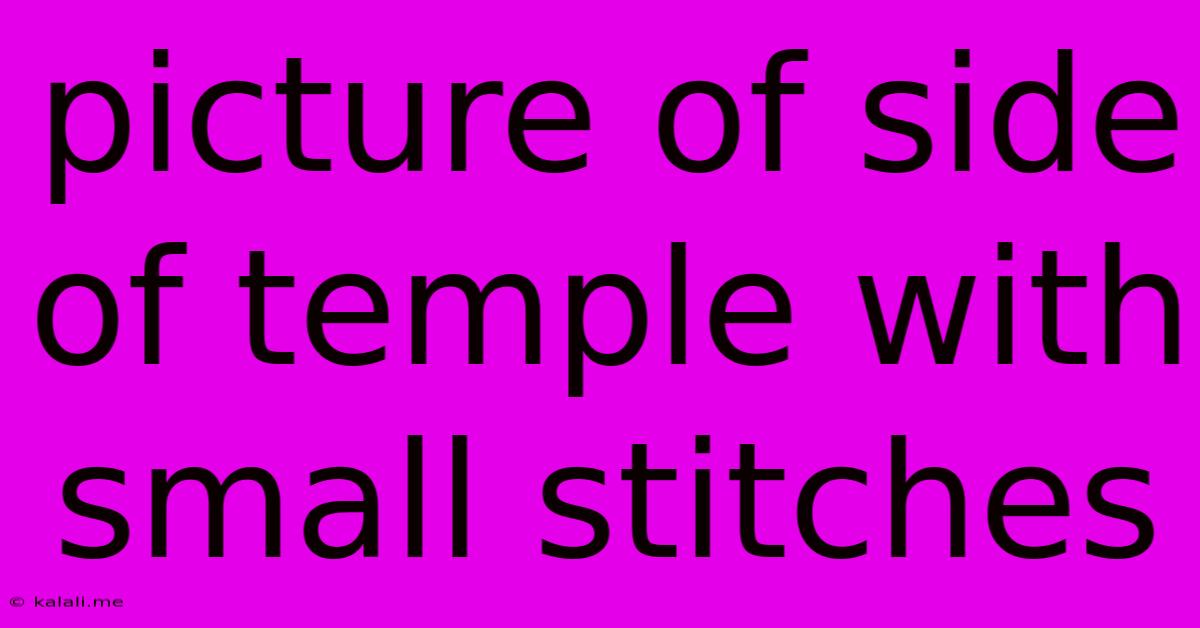 Picture Of Side Of Temple With Small Stitches